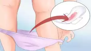 Bleeding during a medical abortion